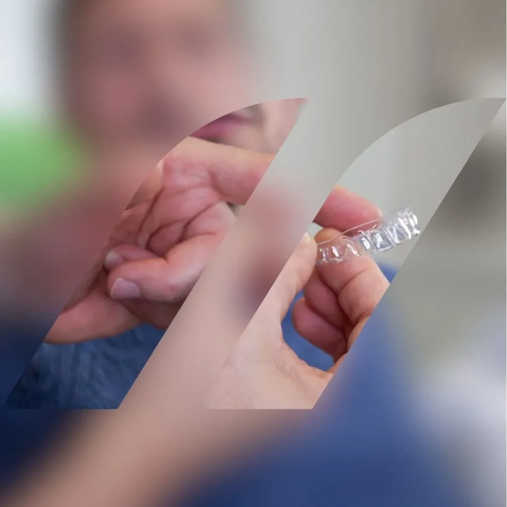 apparecchio trasparente a Lonigo