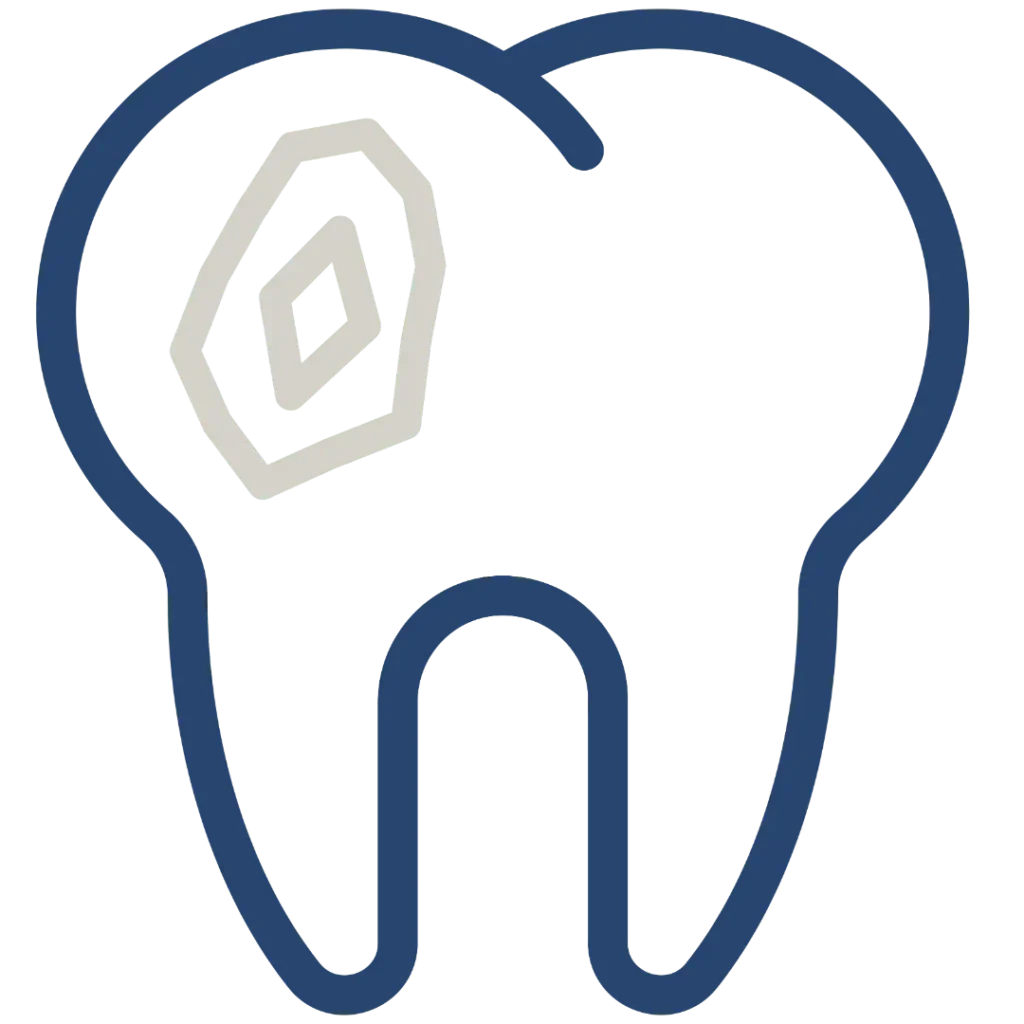 otturazioni a Lonigo