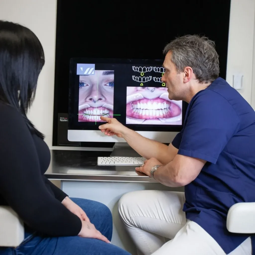 faccette dentali a Lonigo