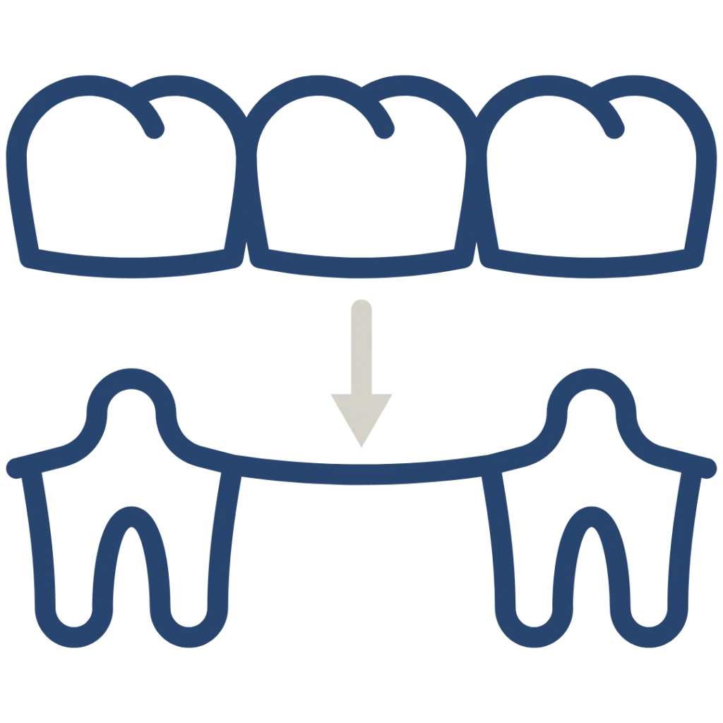 protesi fissa e dentiera a Lonigo